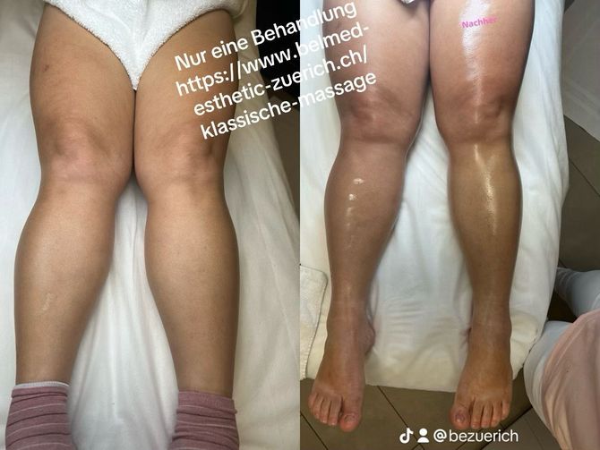 Bodybehandlung