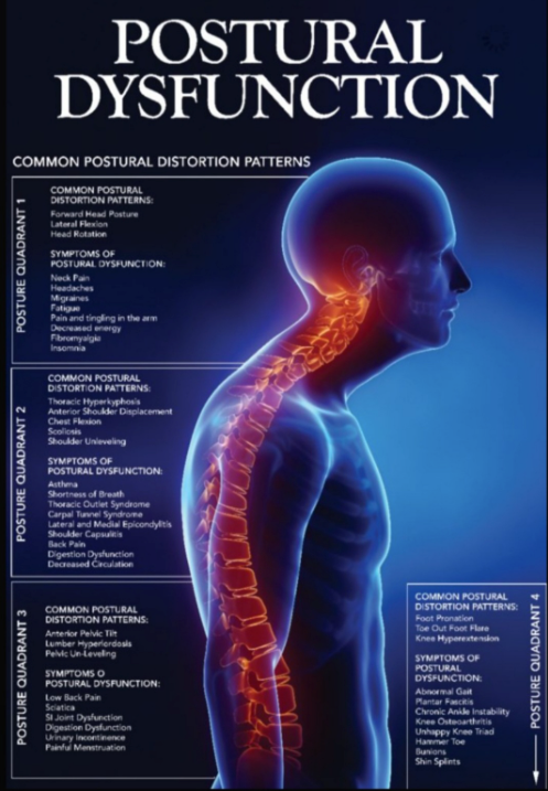 A poster for postural dysfunction shows a man 's spine