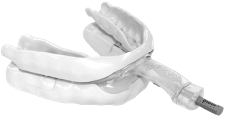 Oral Appliance Therapy