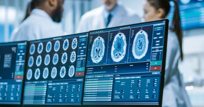 Doctors examining brain scans on multiple computer monitors.