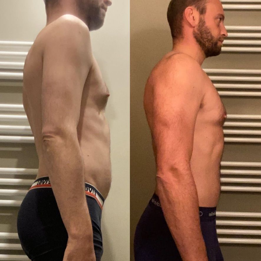 Side-by-side profile photos of the same man before and after weight loss, in dark briefs.
