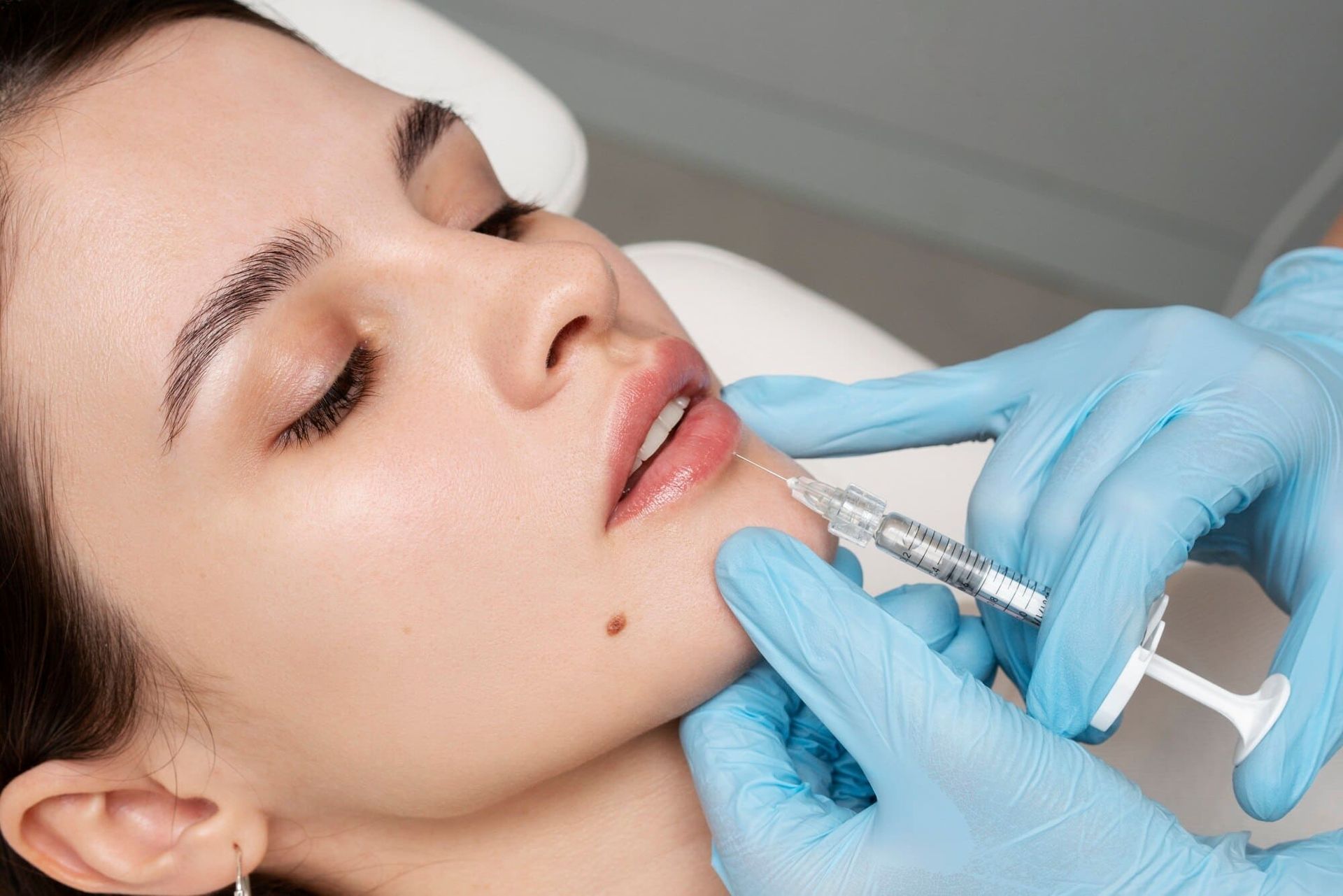 Dermal Fillers Tampa
