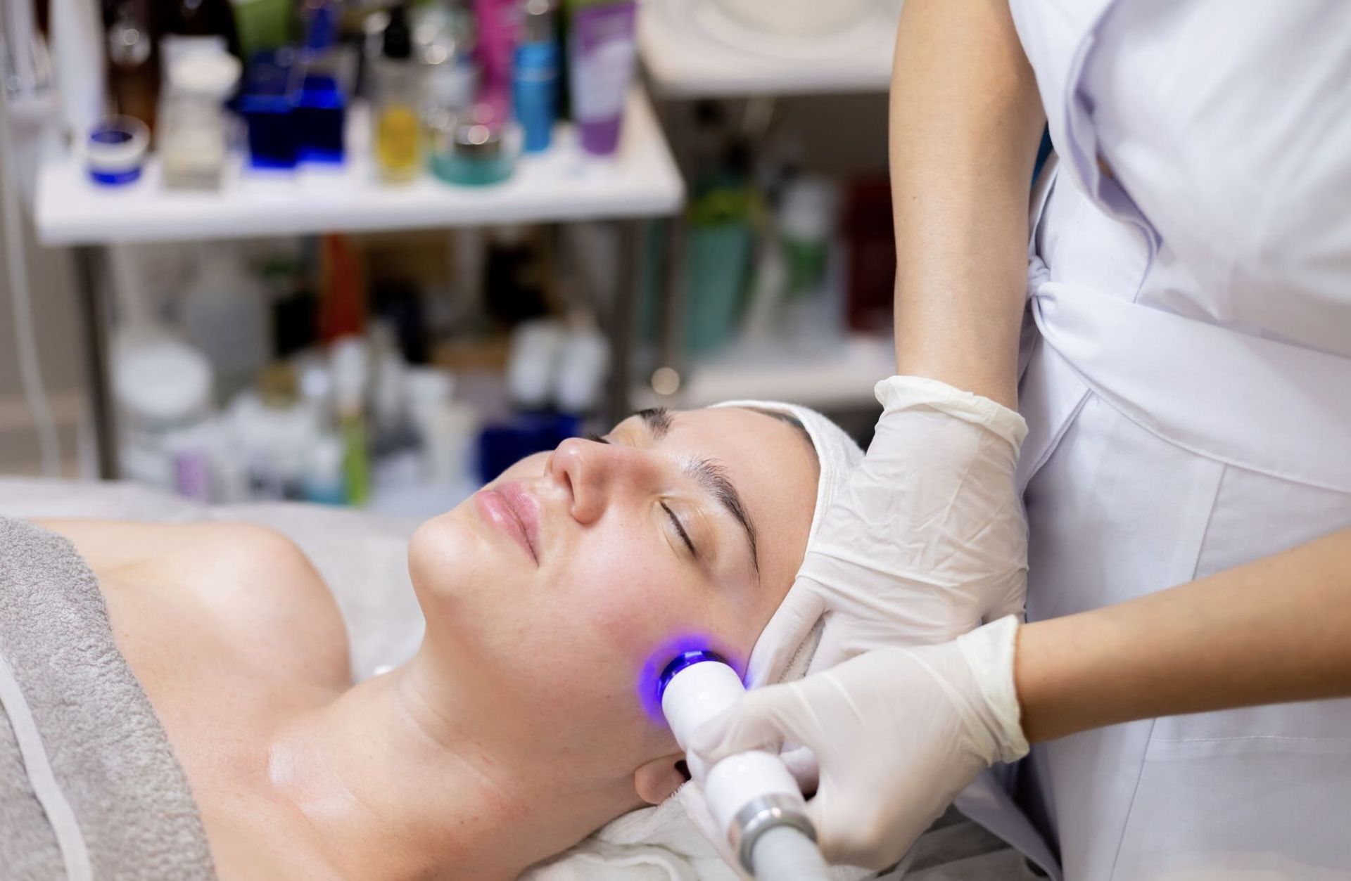 IPL Photofacial Tampa