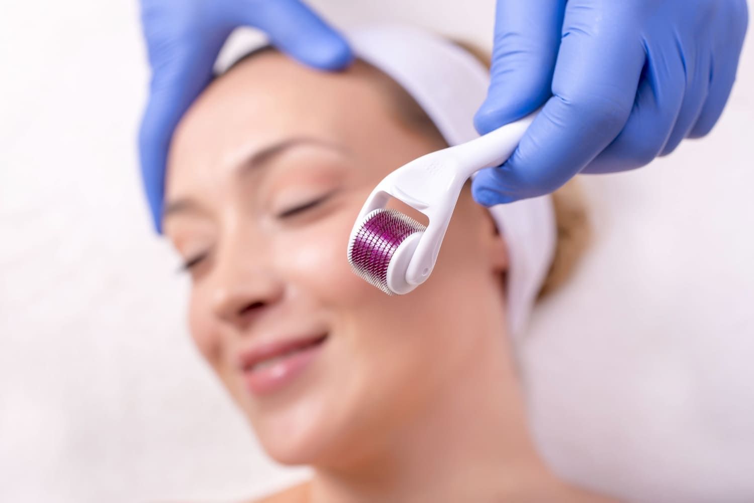 Microneedling Tampa
