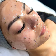 Close-up of a person receiving a clear facial treatment mask, eyes closed, with small applicator dots on the skin