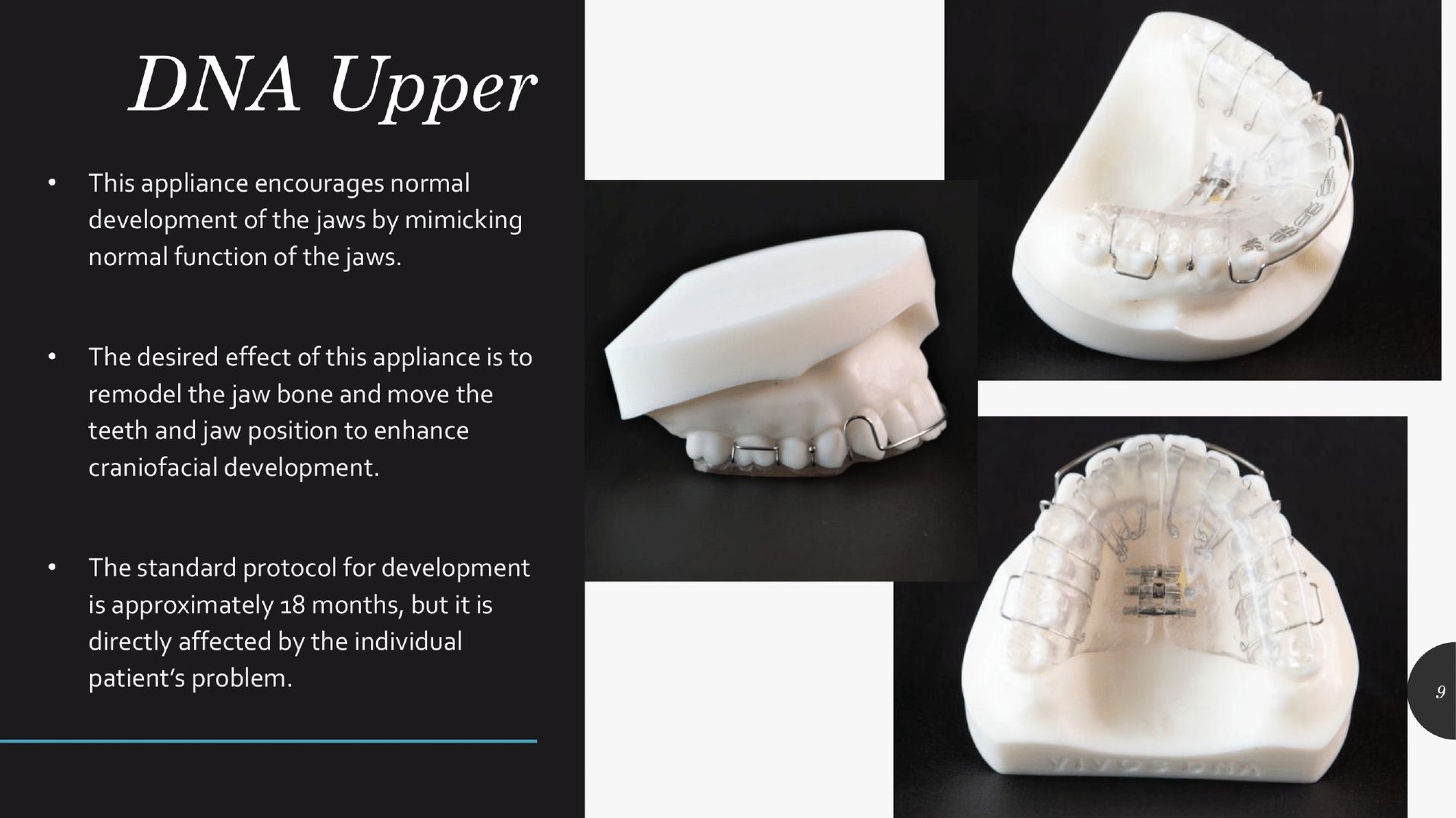 Presentation on DNA upper appliance. Includes models with appliance, and text about its purpose.