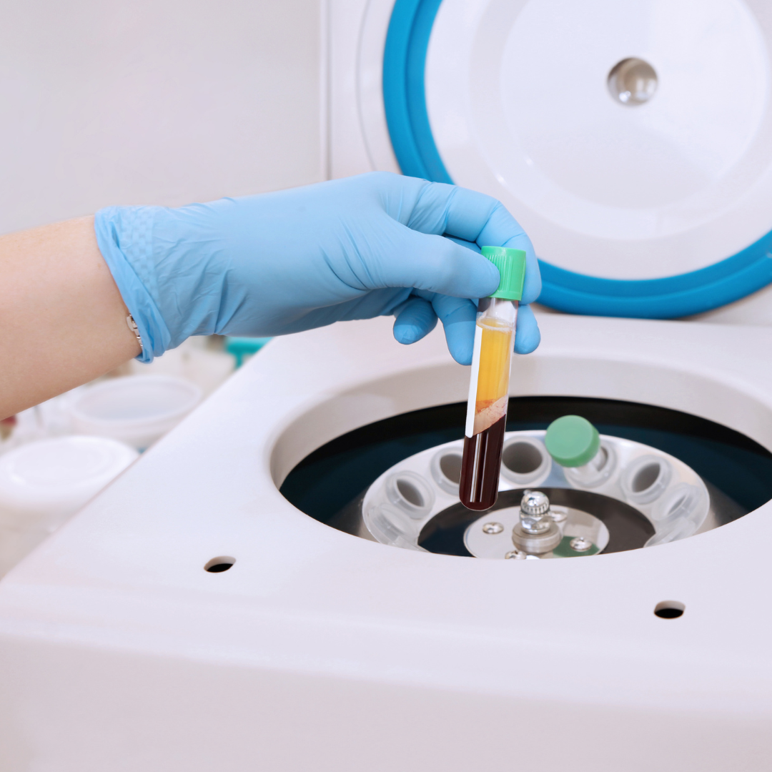 Platelet Rich Plasma process