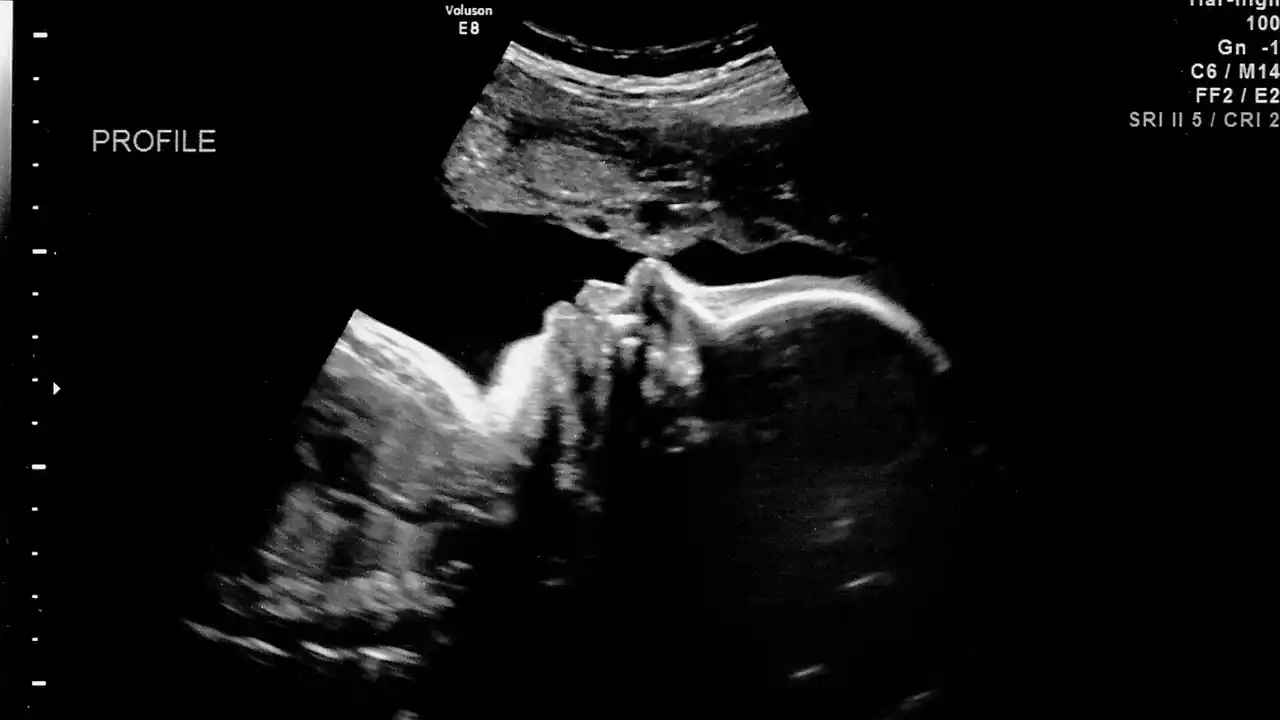 How Does an Ultrasound Produce an Image of a Fetus in the Mother’s Uterus?