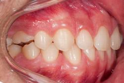 KIDDIE DENTAL ZONE