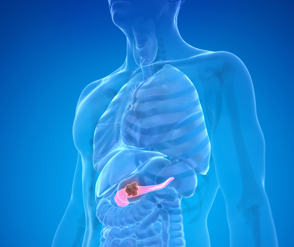 Pancreatic Cancer | Service Page | LA Cancer Network