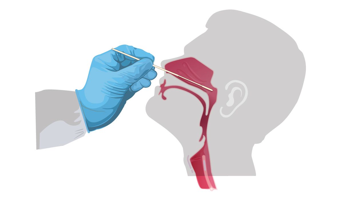 A person is getting a swab from their nose.