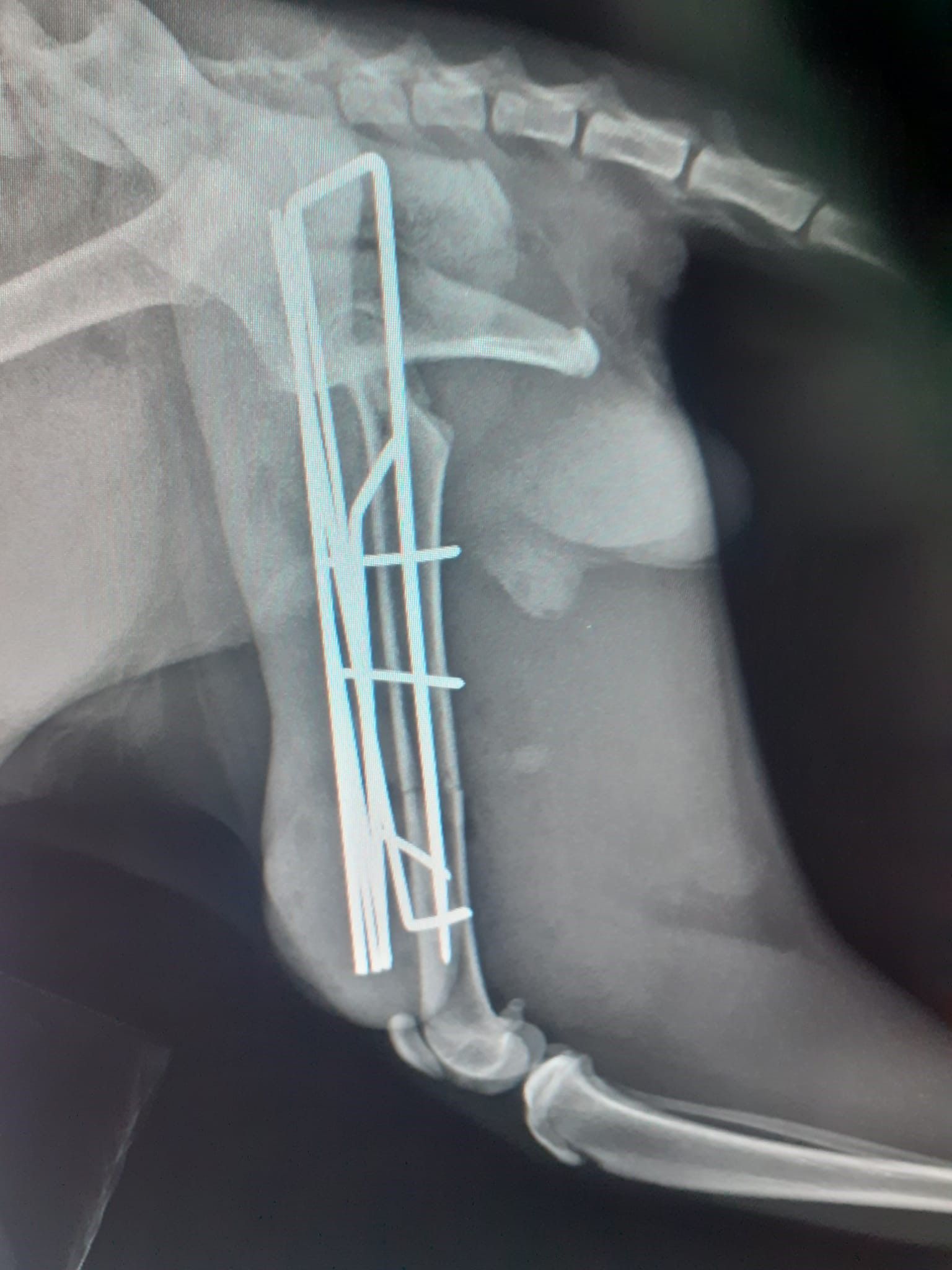 radiografie