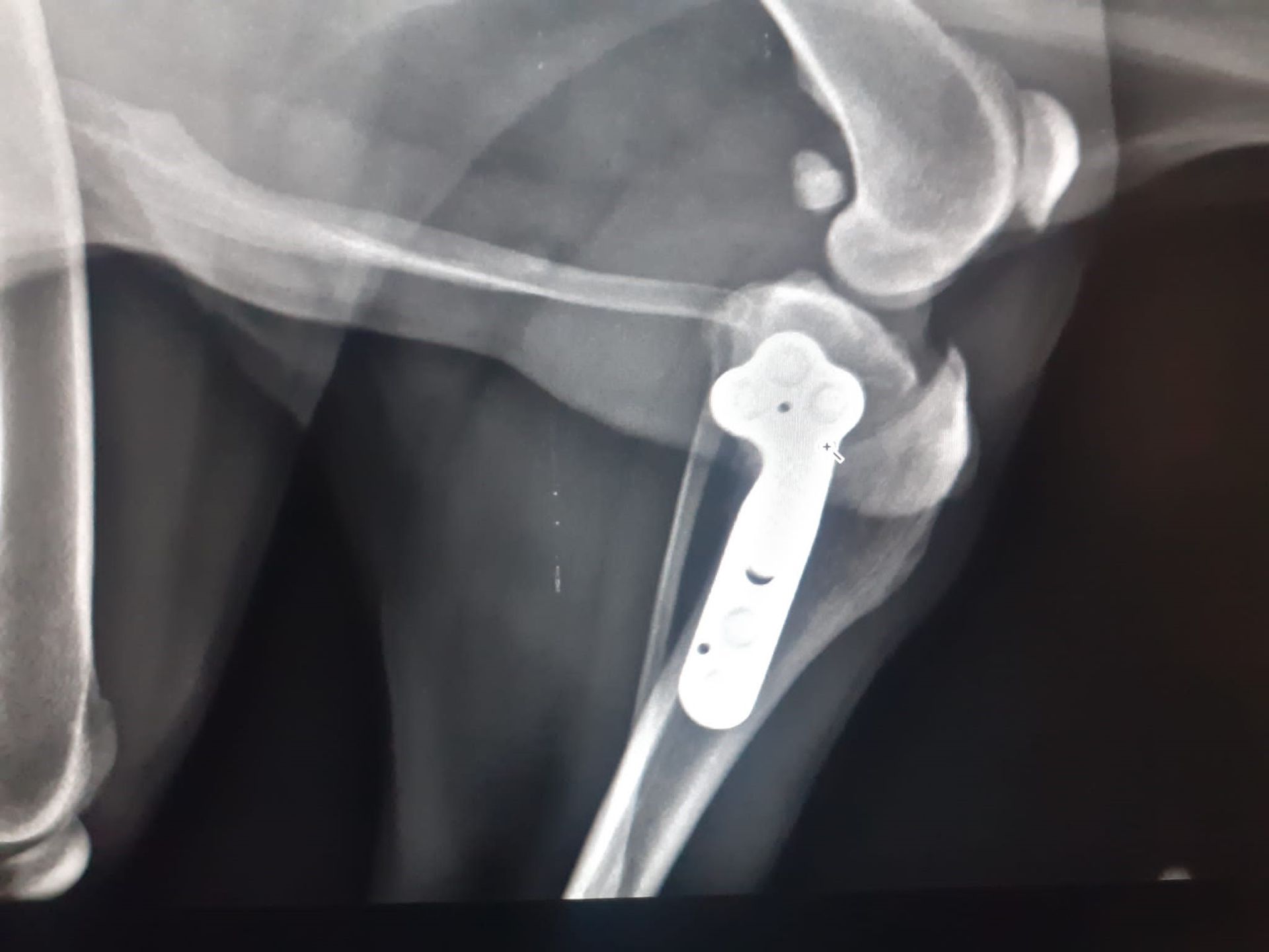radiografie