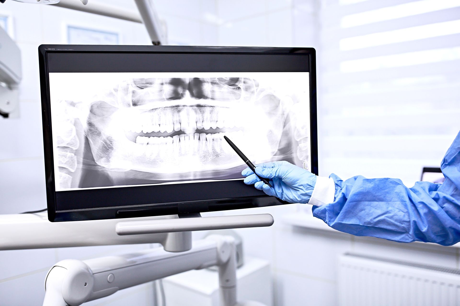 Dentist pointing at dental X-ray on a monitor in a dental office.