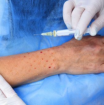 DR. DAVID LÓPEZ ALERGÓLOGO - ANTICUERPOS