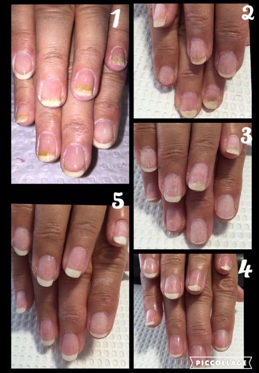 A collage of four pictures of a woman 's nails