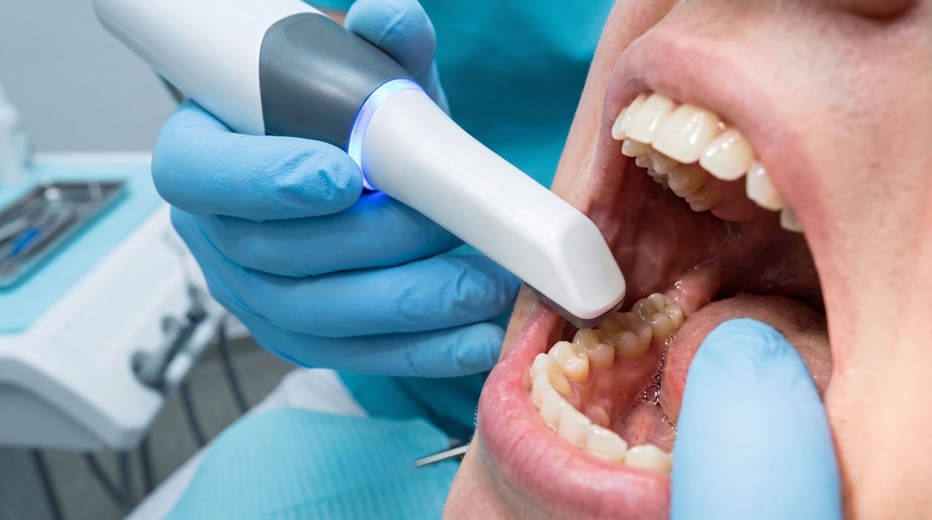 A dentist examines a patient's teeth with an intraoral scanner during restorative dentistry care.
