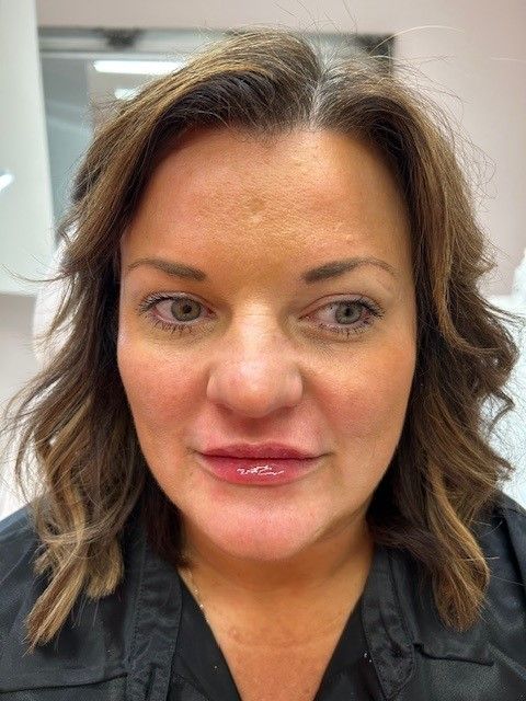 Treatment performed on a Norwich lady