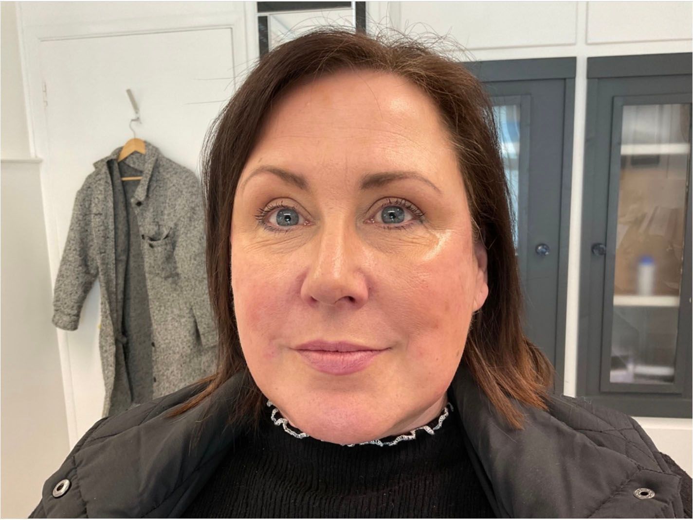 8 point facelift on a Norwich client