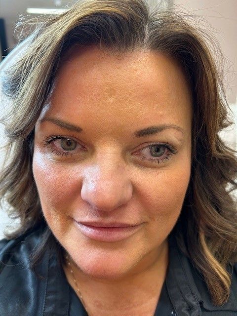 Norwich lady after having a treatment