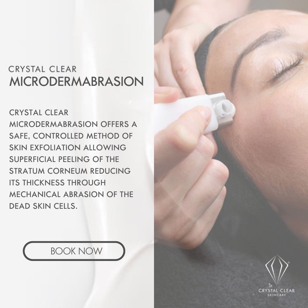 Microdermabrasion removal being performed on the face in Norwich clinic