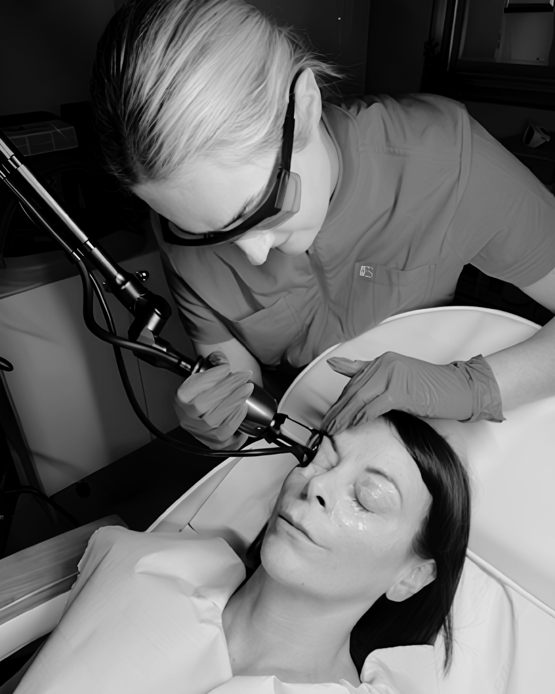 CO2 Laser resurfacing performed on eyes by Rosie in Norwich Aesthetics clinic