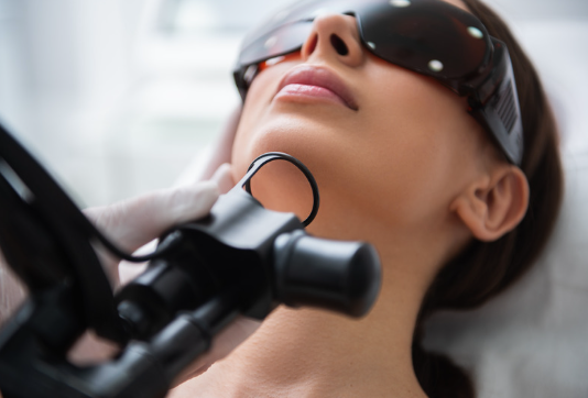 Lady having CO2 LASER resurfacing done on eyes in Norwich clinic