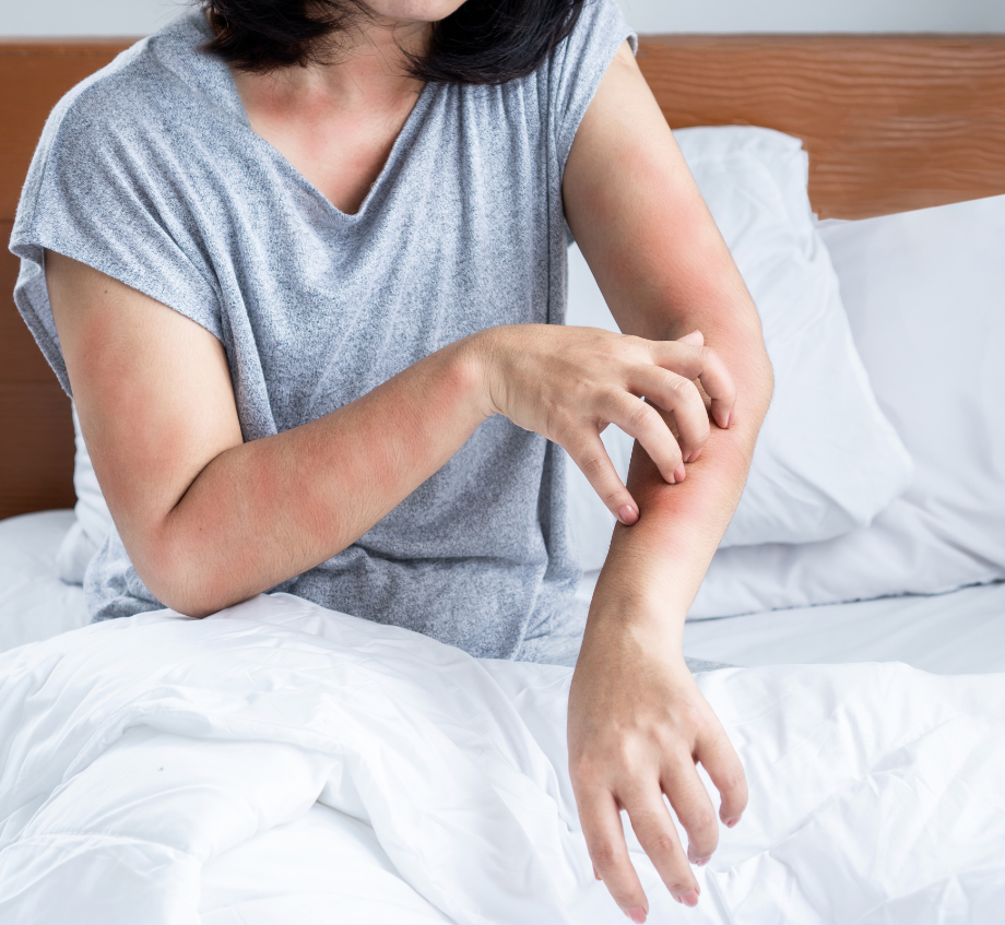 une femme est assise sur un lit et se gratte le bras à cause des punaises de lit