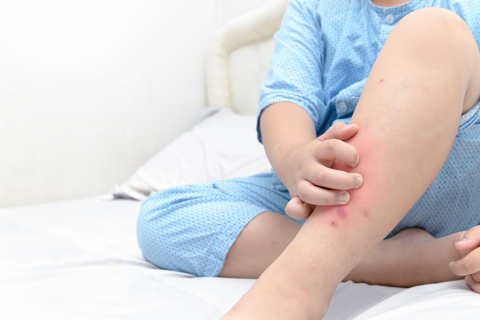 Skin irritation and scratching in children