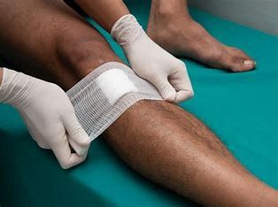 Dressing on wound