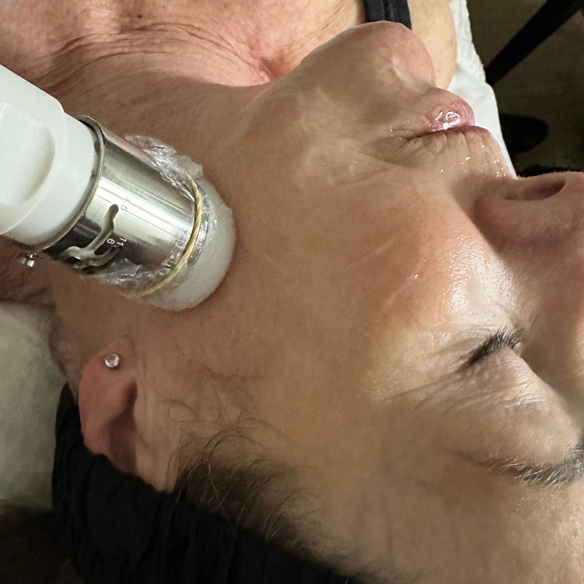 Discover what makes HIFU at HUSH Clinical in South Yarra different. Two machines, real results, pers