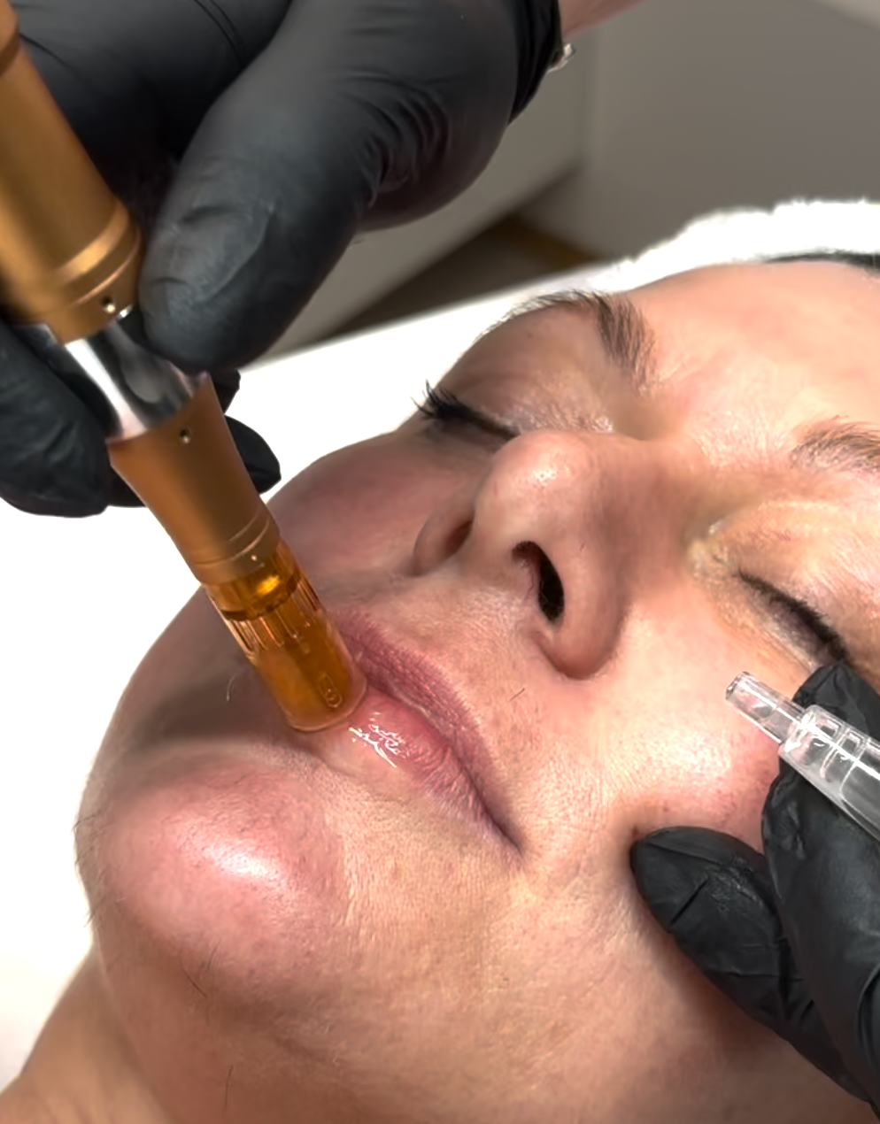 Cosmetic treatment on a woman's face with a handheld device near her lips and cheek