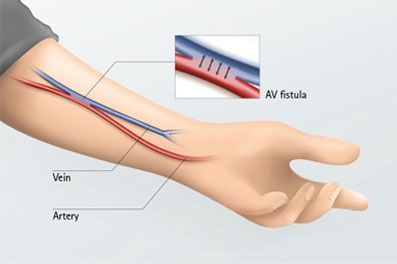 Treatments