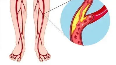 vascular doctor, michigan