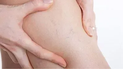 vascular doctor, Michigan, veins & arteries