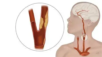 vascular doctor, Michigan, veins & arteries