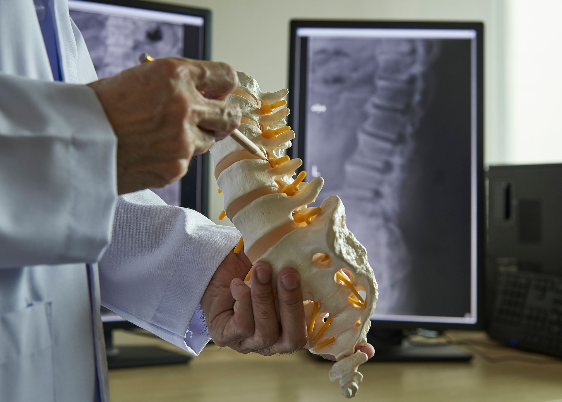 A doctor is holding a model of a spine in his hands — Monroe, LA — Coleman Chiropractic Clinic