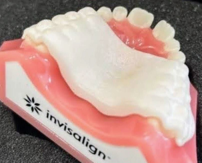 Palatal expander 