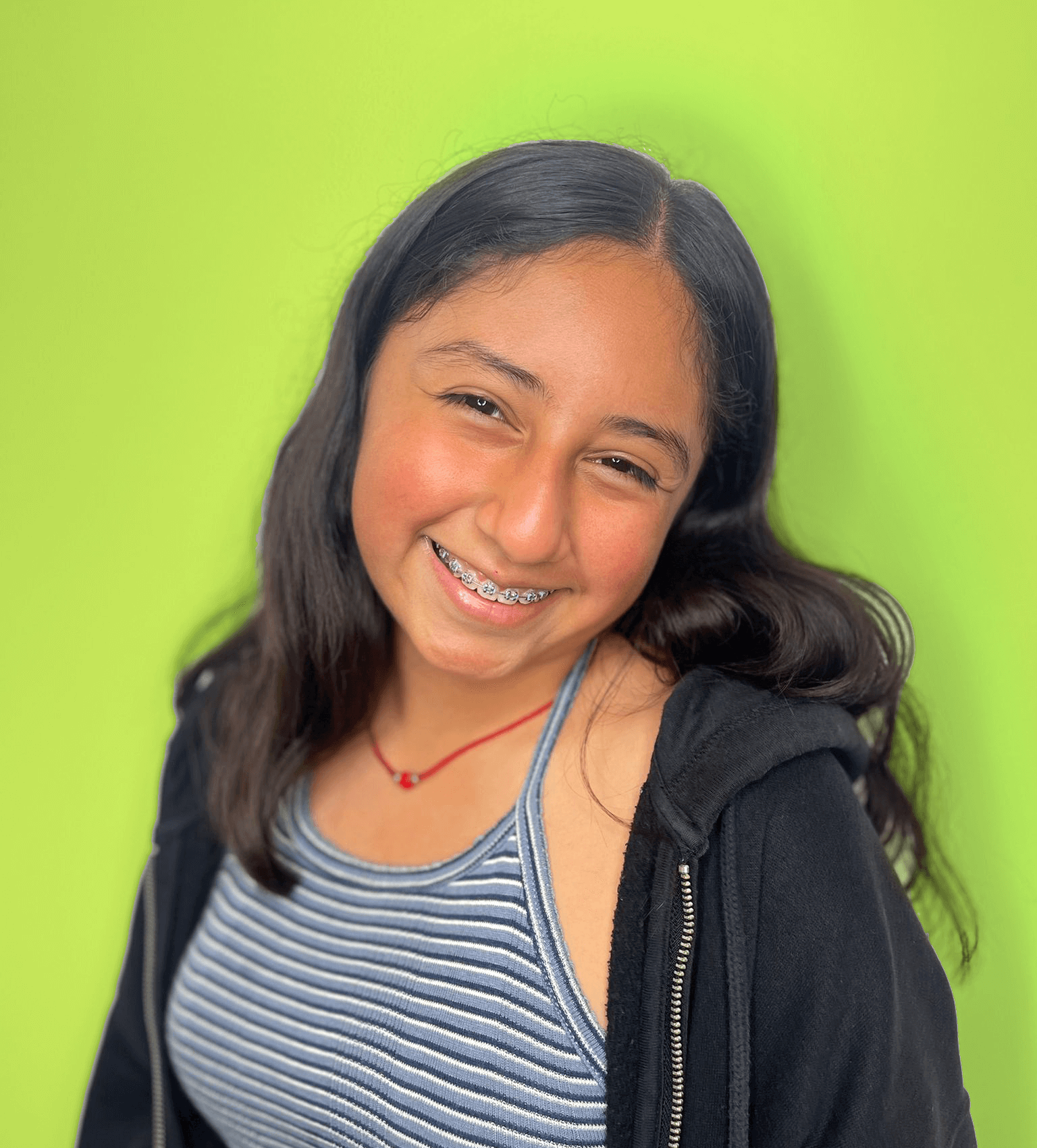 Clear braces in Montebello
