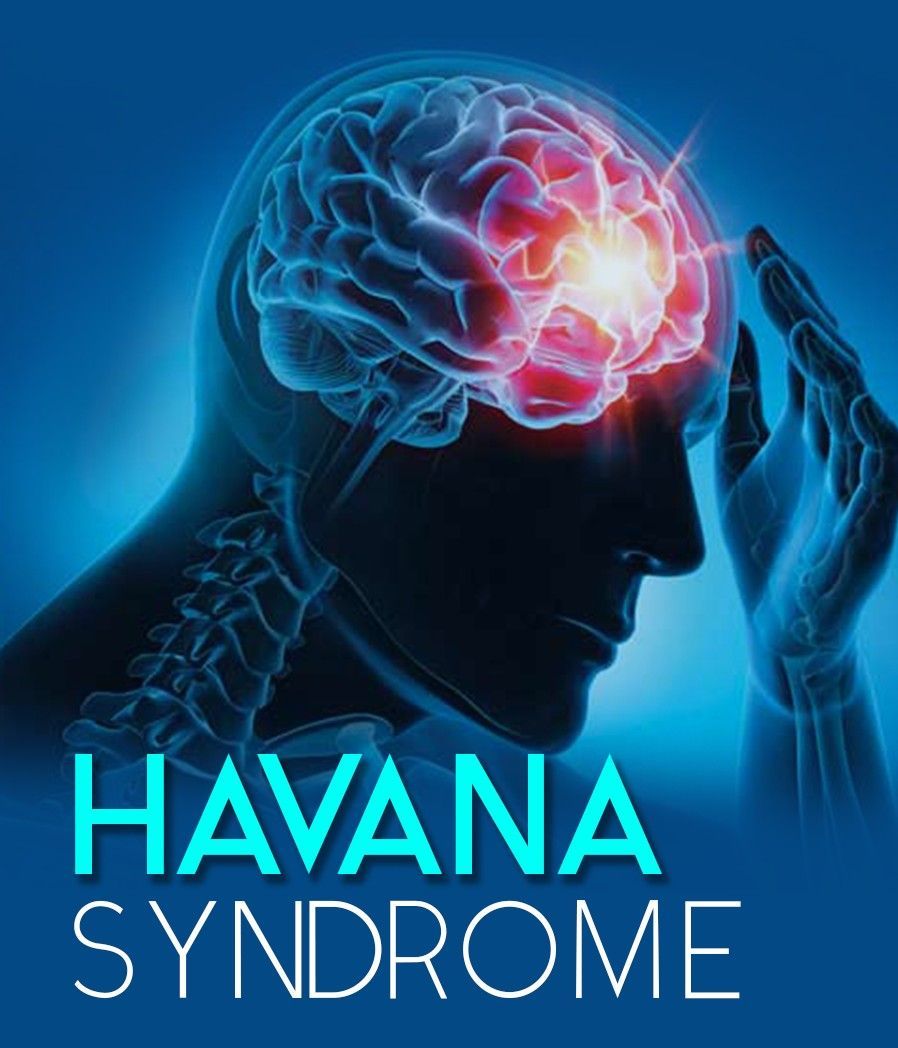 Global Indoor Health Network - Havana Syndrome Global Indoor Health Network - Havana Syndrome might be caused by microwave radiation attacks