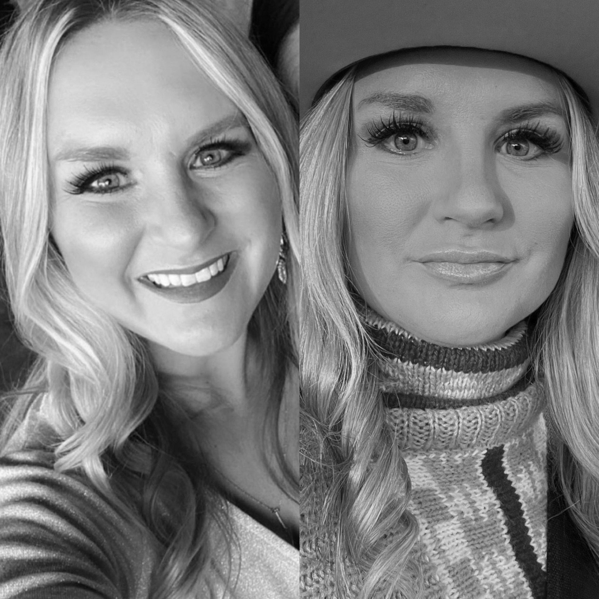 Botox Dysport Fillers Hydrafacial Laser Hair Removal Morpheus8 Med Spa Skin