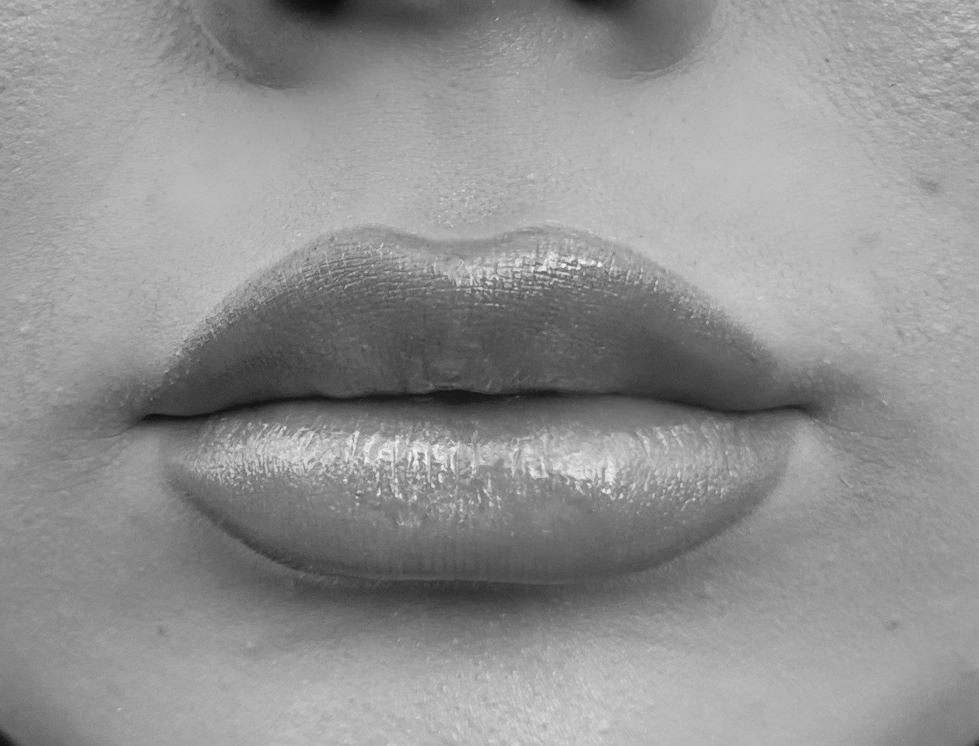 Botox Dysport Fillers Hydrafacial Laser Hair Removal Morpheus8 Med Spa Skin