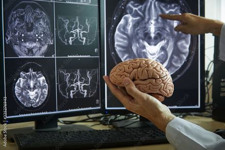 Mãos segurando um modelo de cérebro em frente a monitores de exames médicos cerebrais.
