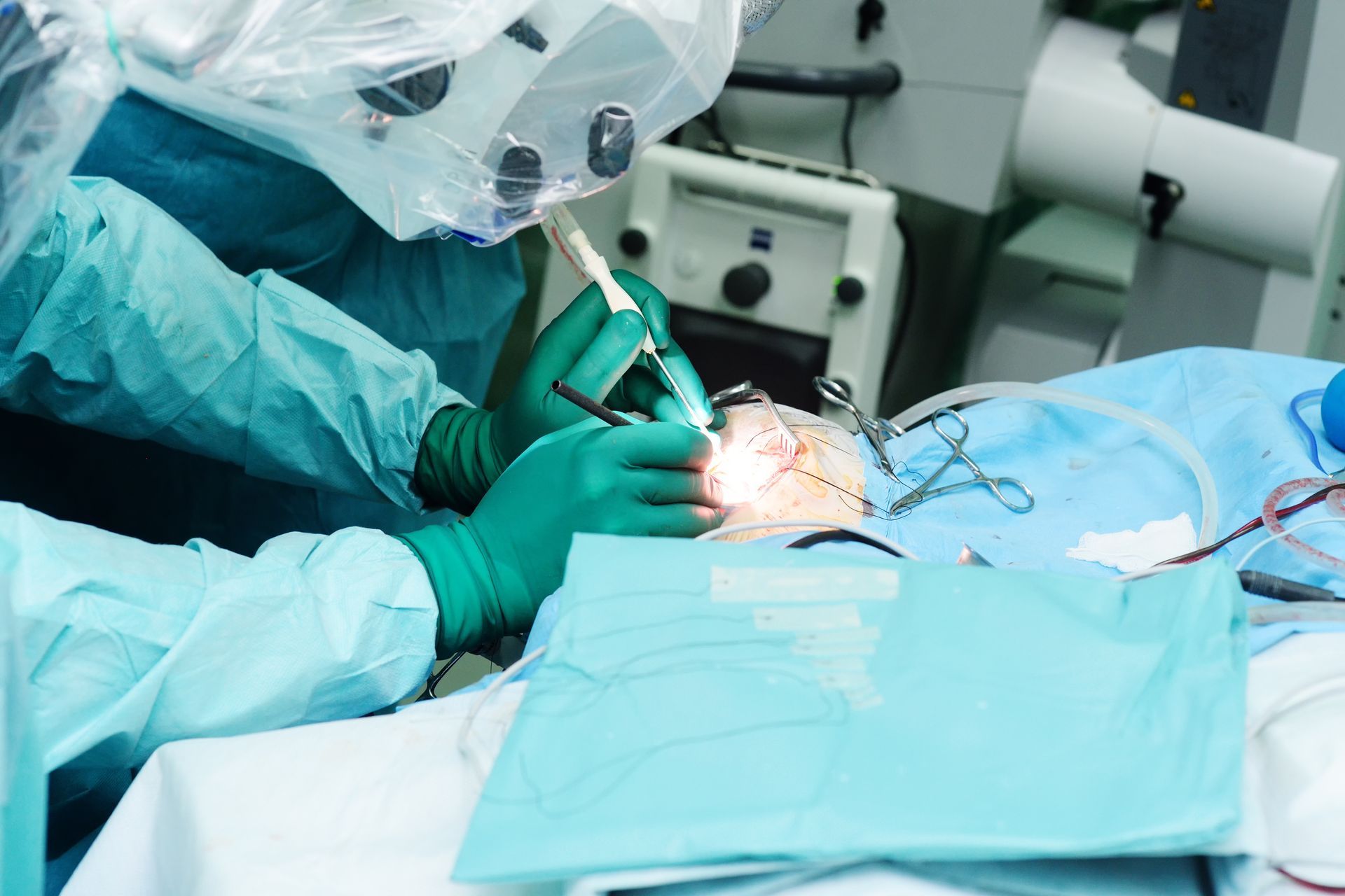 Quando se deve operar o meningioma?