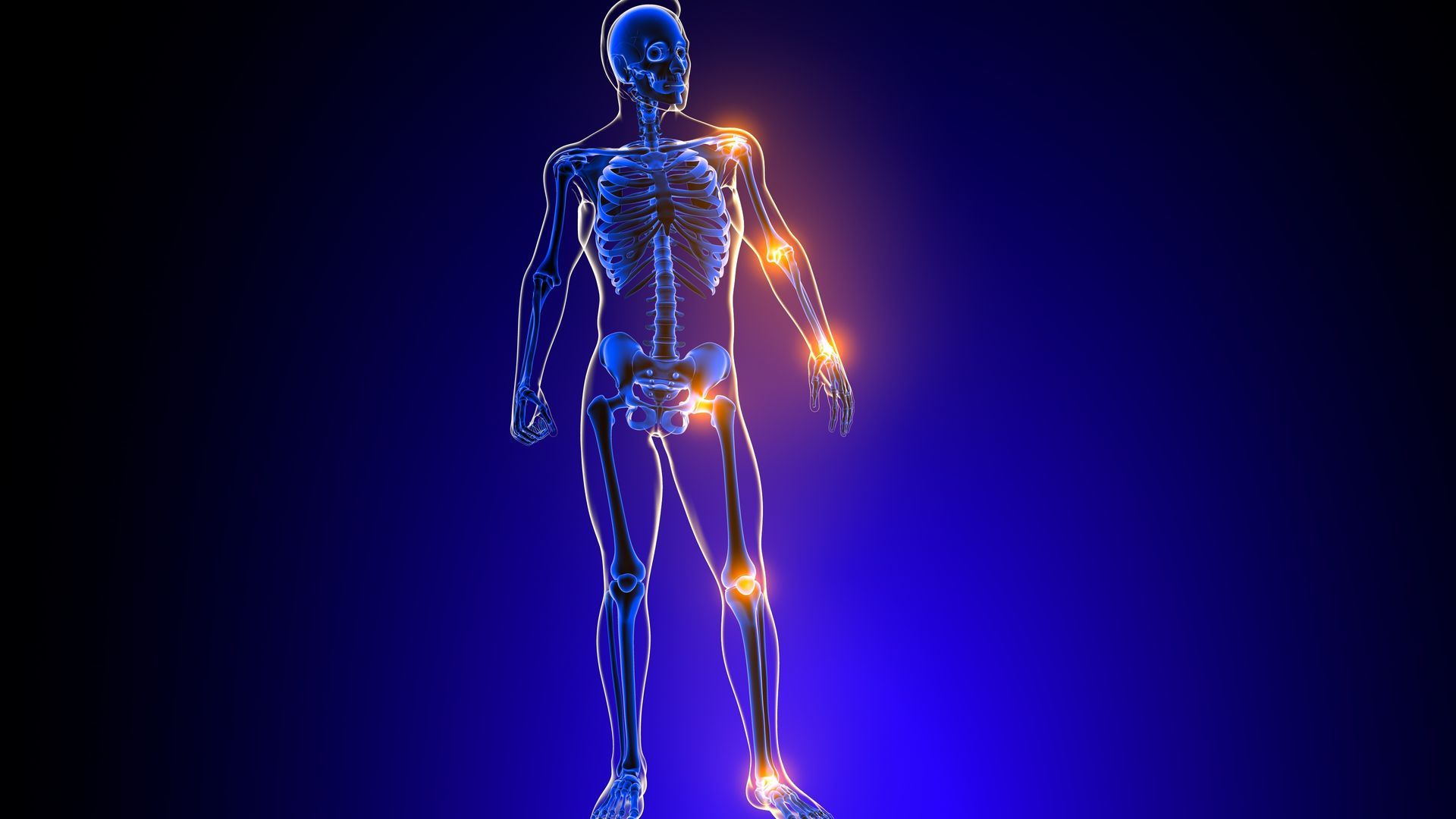 Como é feito o diagnóstico de condrossarcoma
