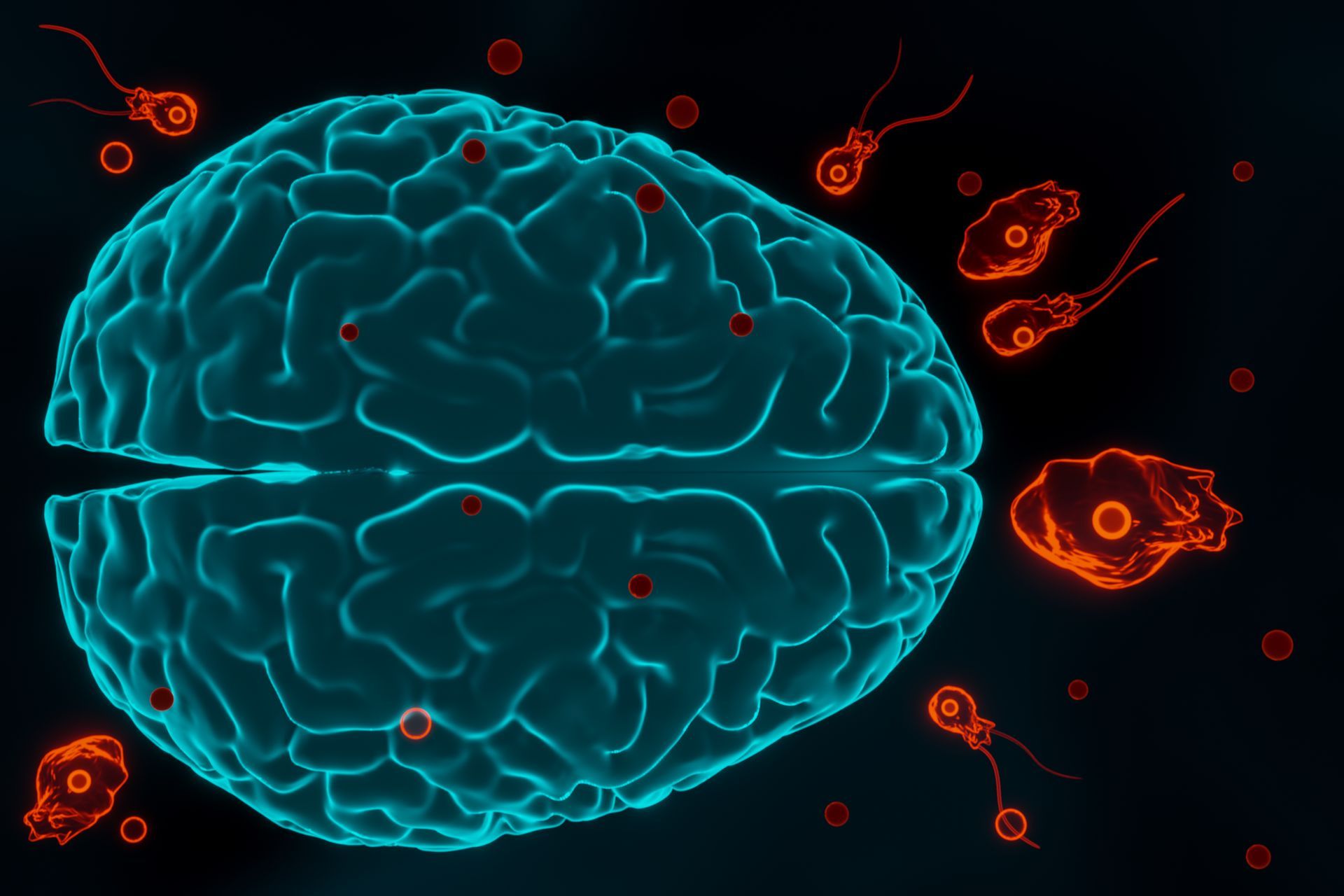 Malformação Arteriovenosa (MAV) tem cura Malformação Arteriovenosa (MAV) tem cura