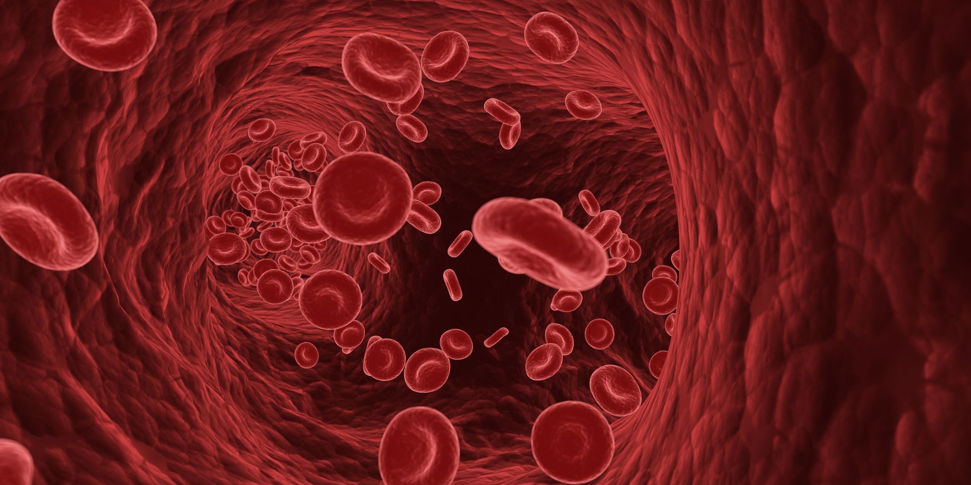 O que é a Malformação Arteriovenosa (MAV) O que é a Malformação Arteriovenosa (MAV)