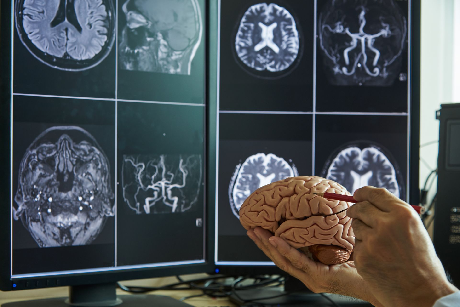 Quais são os tratamentos para Meningioma