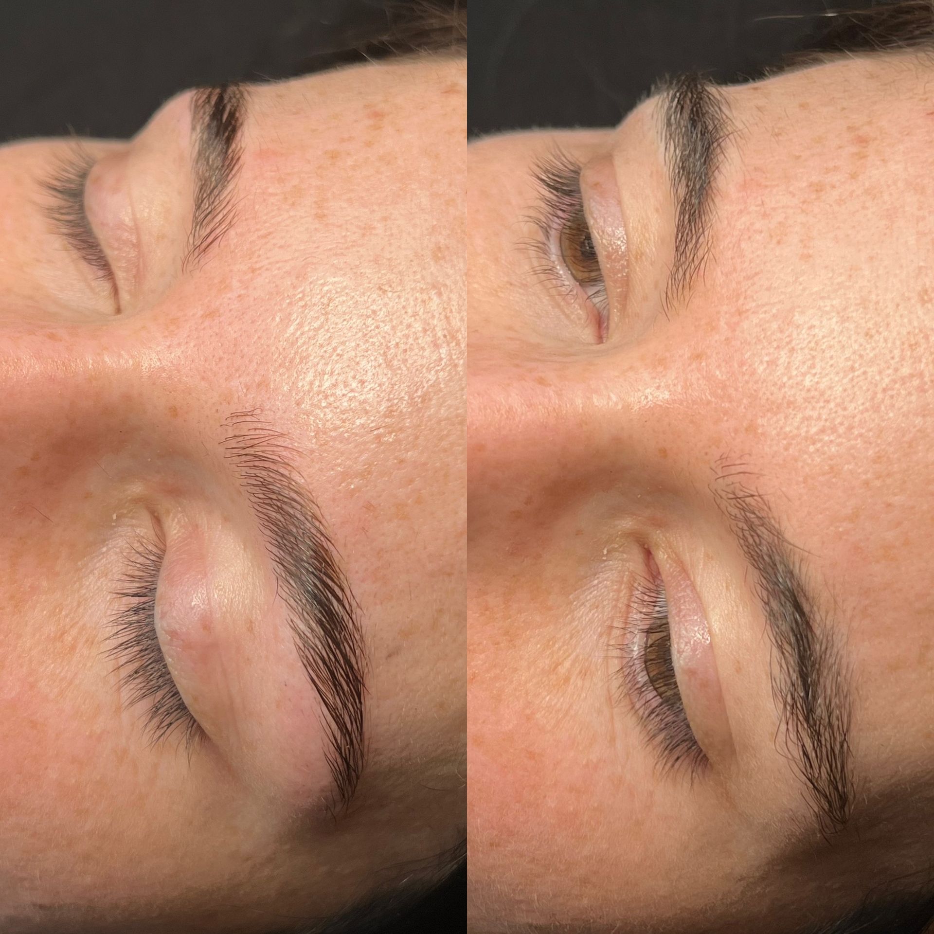 Dermaplaning & Facials in Lexington, KY by Radiant Skin & Brows