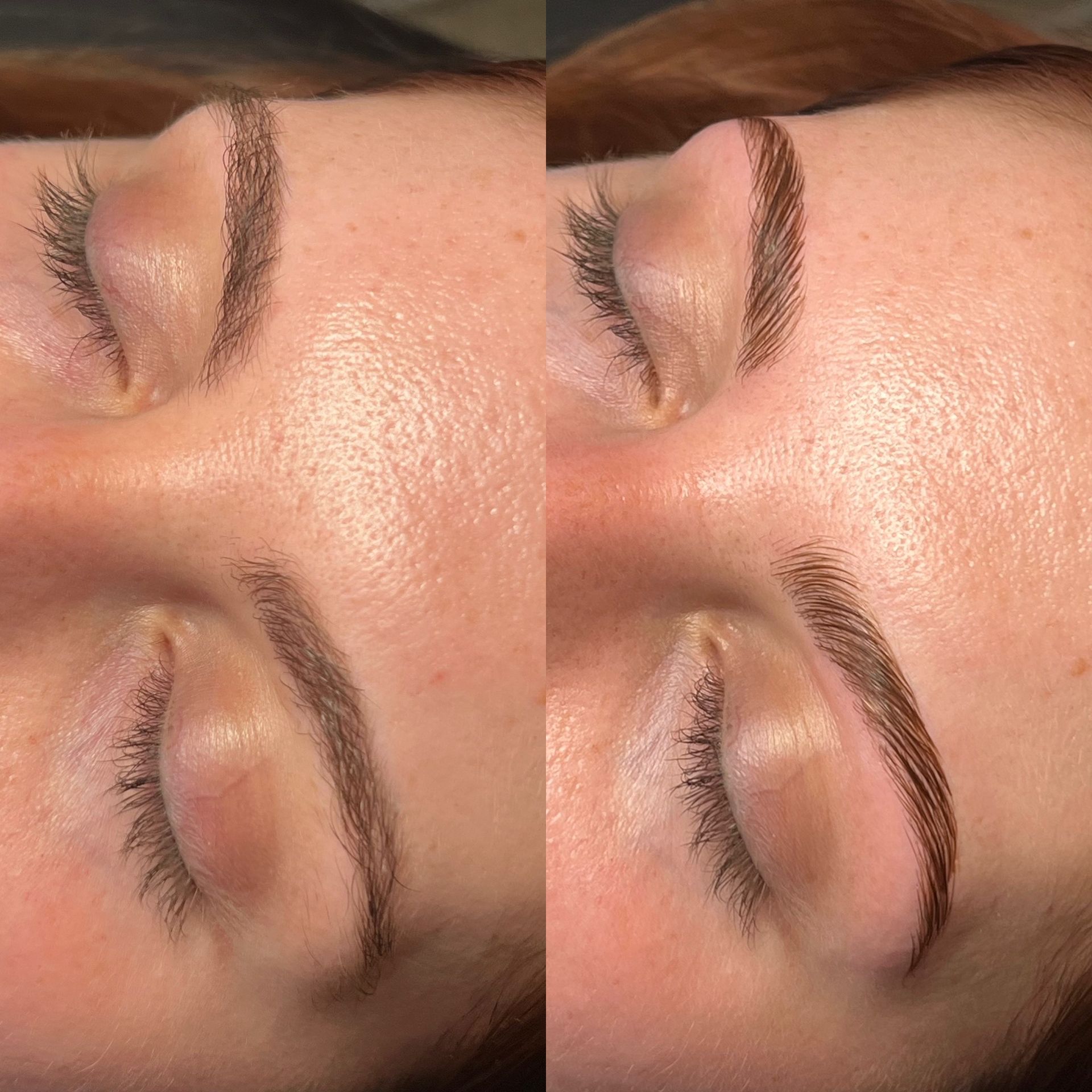 Dermaplaning & Facials in Lexington, KY by Radiant Skin & Brows